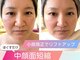 オリファインサンサン(Orefine33)の写真