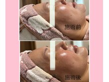 CBDサロン ローズ(ROSE)の雰囲気（20代～60代の方多数ご来店。スッキリ、ハリツヤのある肌へ。）