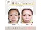 小顔整体研究所 KSラボ 健軍店の写真