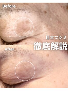 イデアーレ(ideale)/60代・肌育すれば必ず変わります