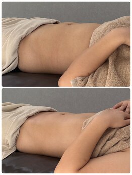 ティエルプラス(tiele+)/骨盤調整×HOT腸もみ