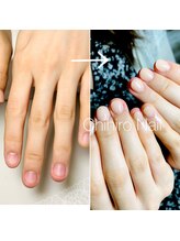 チヒロネイル/爪噛み保護スカルプ