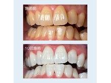 クレア(Crea)の雰囲気（10回（1ヶ月）で綺麗な白い歯に。笑顔に自信♪）