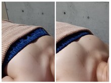 ミラクルバスト 松山店/ビフォーアフター１回施術