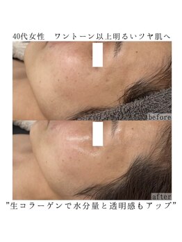 ヴェルシック(Belchic)/お肌の弾力とハリ感も上がる