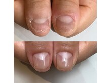 ココ(COCO)の雰囲気（（施術事例）保育士さんも６ヶ月で美爪さんに/育爪/深爪/反り爪）