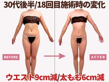 べモーレ 上本町 谷町九丁目(Bemolle)の雰囲気（結婚式を控える花嫁様の痩身エステも多く担当させて頂いてます☆）