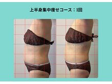 サロンビオーナ(SALON Biona)/大人の本気ボディ改革全身ケア