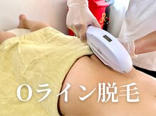 メンズオージー 岡山中区(men's O.G)/メンズ｜Oライン脱毛(肛門周り)
