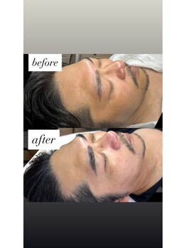 クラン(CLAN)/プロパワーピール