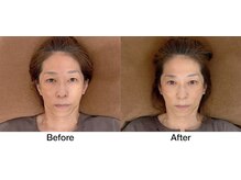 こじま 富雄団地接骨院/たるみ・くすみ