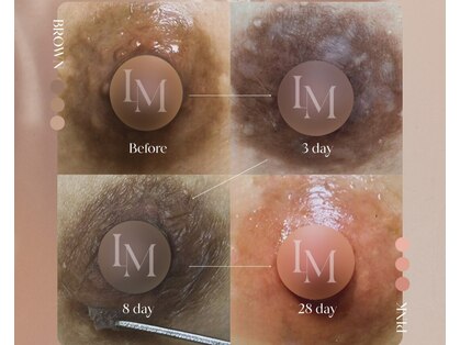 ロゼ(Rose)の写真