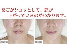 サロンミッシェル(Salon Michel)/