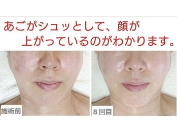 サロンミッシェル(Salon Michel)/