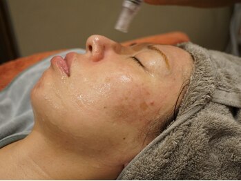 ミモザの写真/地域希少のハイドラを超える毛穴洗浄☆目に見えないほどの微細なスチームで毛穴の奥の汚れまで徹底オフ♪