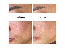 サロン シェリール(Salon Cherir)/ダクトピール　B/A