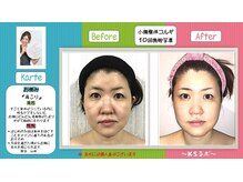 小顔整体研究所 KSラボ 天王寺店/