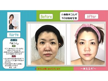 小顔整体研究所 KSラボ 天王寺店/