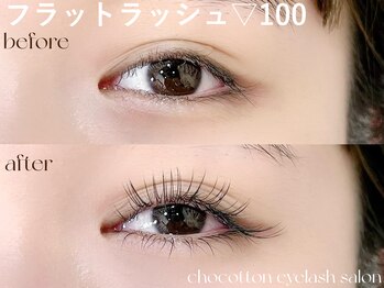 チョコットン 新宿東口(chocotton)/モチの良さ◎フラットラッシュ