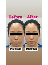 ゆうはり鍼灸整骨院 恵比寿/お客様Before　After