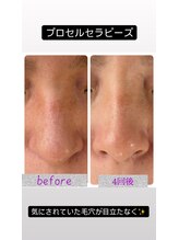 ルシアス(LUCIAS)/プロセルセラピーズ