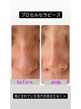 ルシアス(LUCIAS)/プロセルセラピーズ