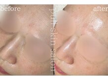 プルスキンサロン 大阪店(pull skin salon)の雰囲気（肌管理/スキンケア／インナーケアまでお伝えします。徹底肌改善!）