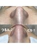 【人気NO1】角質ケア＆毛穴エクストラクション　通常¥13,000→初回￥10,000