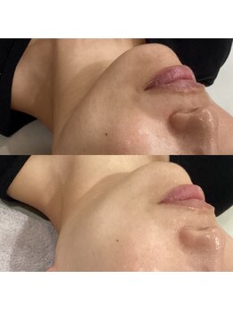 ランタン(Lantern)/タラソトリートメント