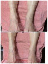 フットケアサロン ラビフット(Rabbi foot)/怠い浮腫み脚