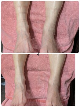 フットケアサロン ラビフット(Rabbi foot)/怠い浮腫み脚