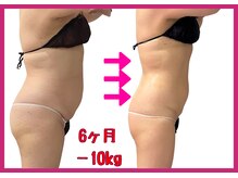 シュエットプラス(Chouette+)