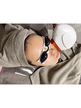 シミしわ改善！予防ケア