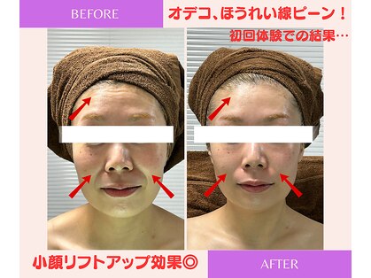 ユーフォリア(Euphoria)の写真