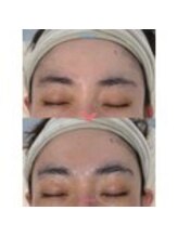 ミスキー 荻窪西口店(misky)/艶肌フェイシャルワックス