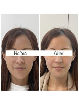 ウニカ(Unica)/BeforeAfter