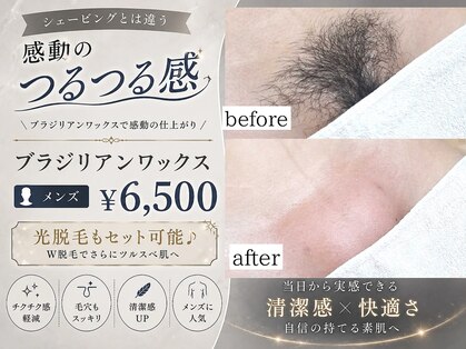 ファースト(1st)の写真