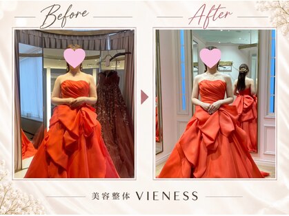 ヴィーネス(VIENESS)の写真