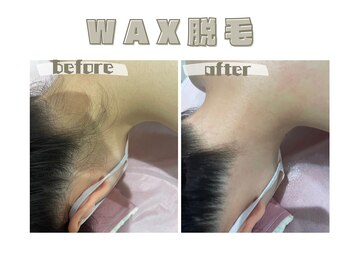 レヴィート(Revept)/【ワックス脱毛】