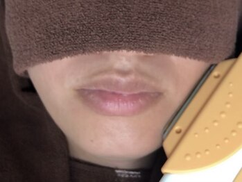 美痩身(bisoshin)の写真/待望のメンズ脱毛もご用意!!【最新高速美肌脱毛☆お試し全身(VIO+お顔付)1回】低価格で通いやすさ◎