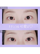 コトリ(kotori)/アイリッドアップパーマ