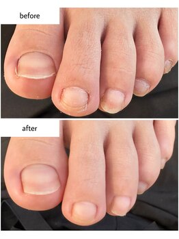 ケアプラス(care plus)/フットネイルケア