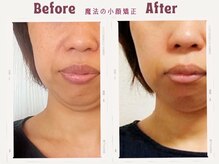 ハッピービューティーサロン じゆう(Happy Beauty Salon J∞YOU)/４０代！Ｋさん♪