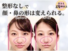 隆鼻矯正専門店 ラプリエイル 千葉店(Raplit aile)