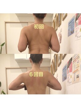 ディア スプリーマの写真/口コミ高評価◎結果を求めるなら当サロンへ★最新技術とゴッドハンドでがっつり痩身！見た目の変化に感動！
