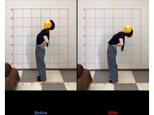 北春日部接骨院/腰　　ビフォーアフター