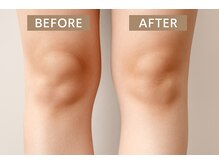 アプロ(Aphro)/膝スッキリ美脚