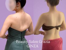 グラツィア 銀座(Grazia)/8回【 ブライダルエステ整体 】