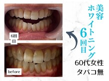 ルカノン(le canon)/毎日のお出かけが楽しいです…☆