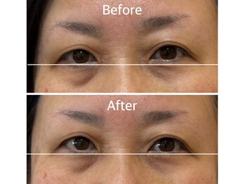 ドクターボディクリスタル(Dr.Body Crystal)/40代後半